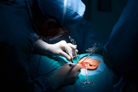 Ossiculoplasty Treatment Cost 