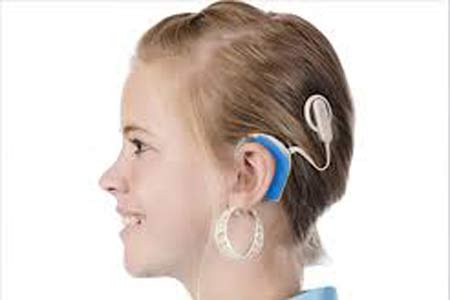 Cochlear Implant Treatment Cost 