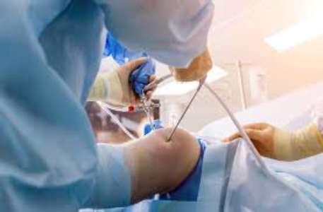 Meniscectomy Surgery Treatment Cost 