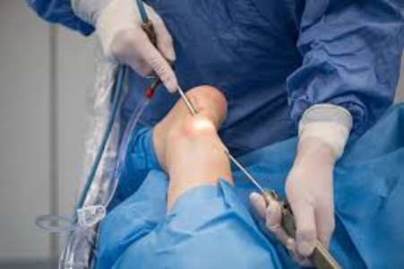 Ankle Arthroscopy Surgery Treatment Cost 