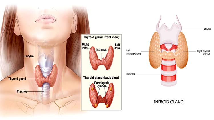 Thyroidectomy Surgery in India