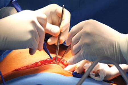 Affordable Cost of Gastrointestinal Surgery in India