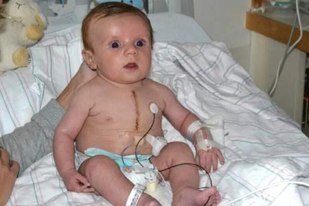 pediatric cardiac surgery types