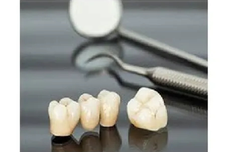 Dental Crown Treatment Cost
