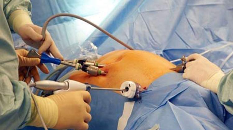 Gallbladder Removal Surgery in India