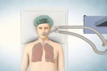 Cost For Lung Transplant in India