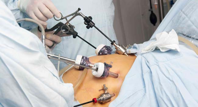 Bariatric Surgery Cost in India