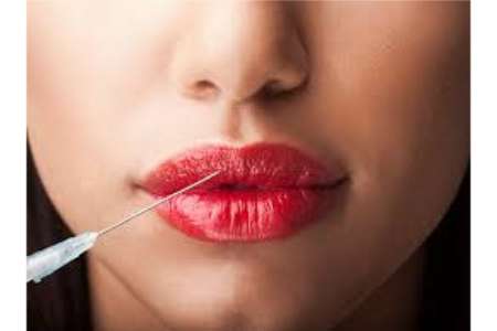 Cost for Lip Augmentation in India