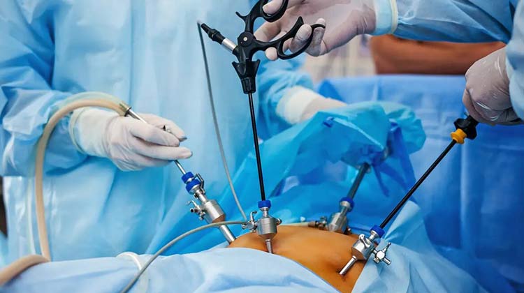 Laparoscopic Surgery Cost in India
