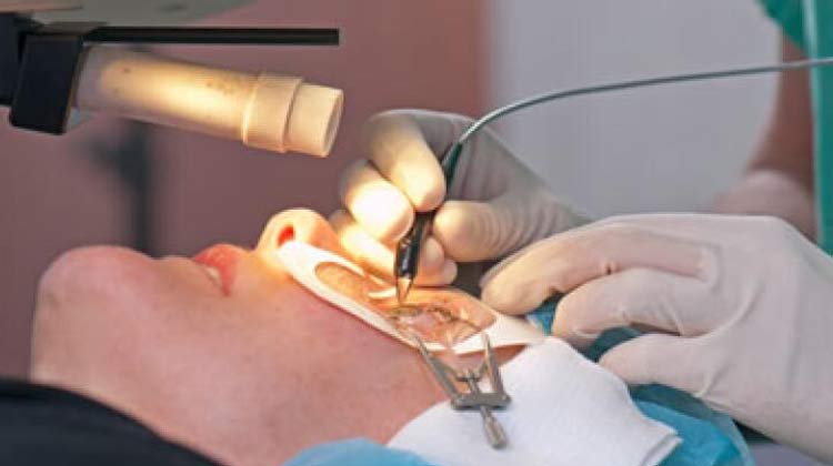 Eye Surgery in India
