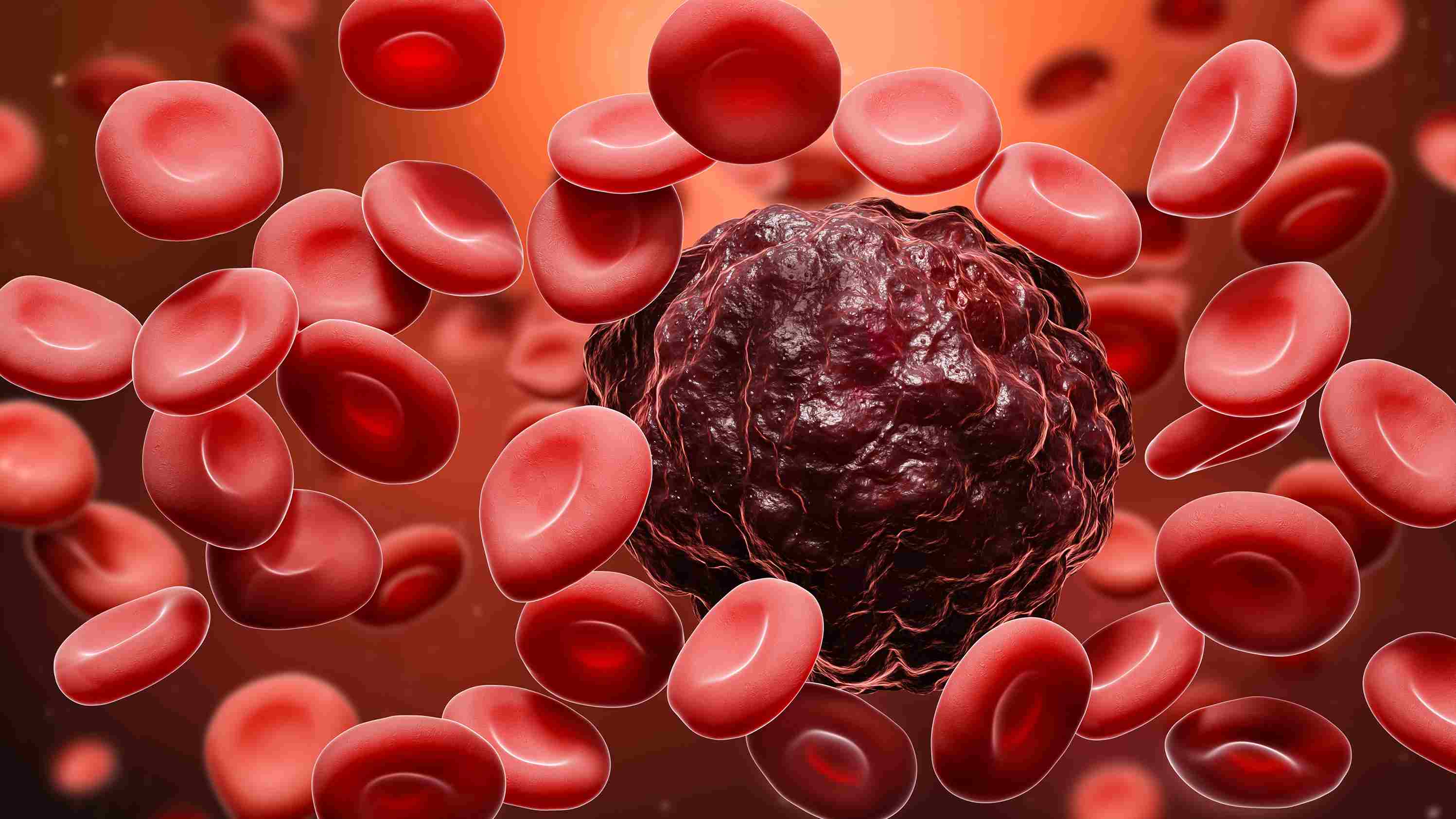 Blood Cancer Treatment Cost in India