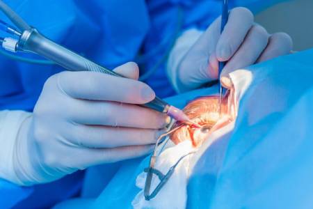Iris Implant Surgery Diagnosis
