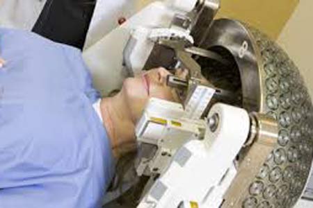 Gamma Knife Surgery in India