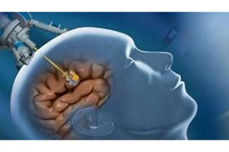 Low Cost of Brain Tumor surgery 