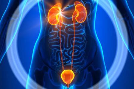 Affordable Cost Kidney Stone Removal Surgery in India
